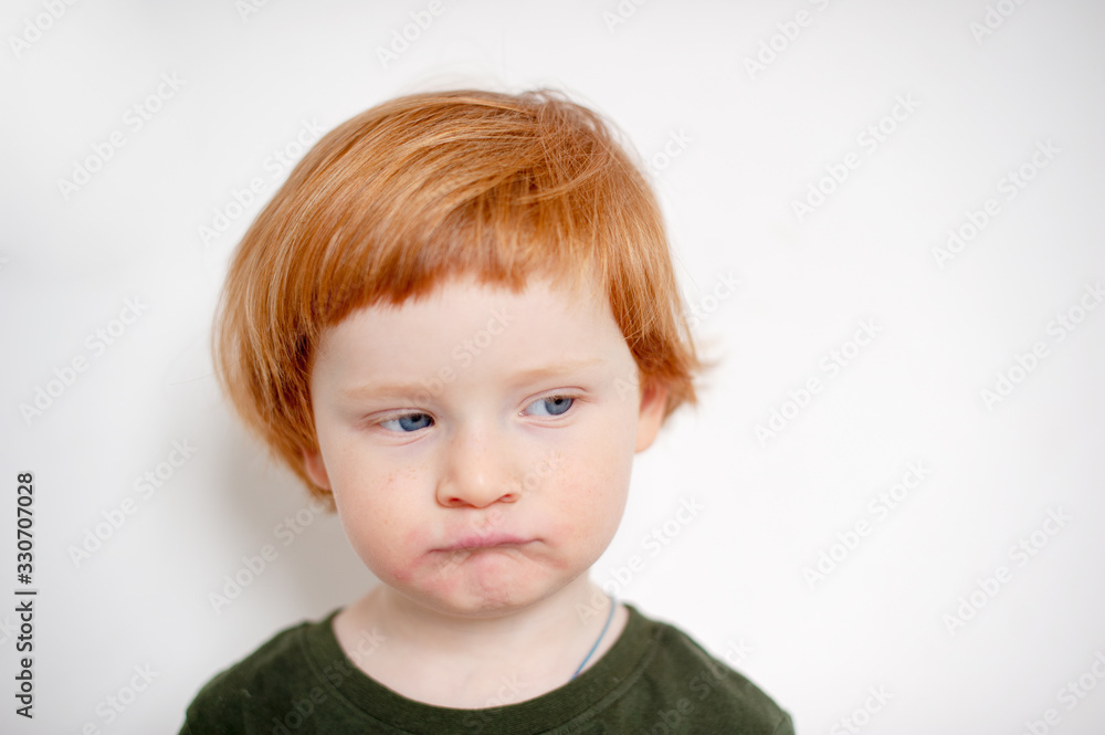 Boy with allergies on his face Boy with allergies on his face