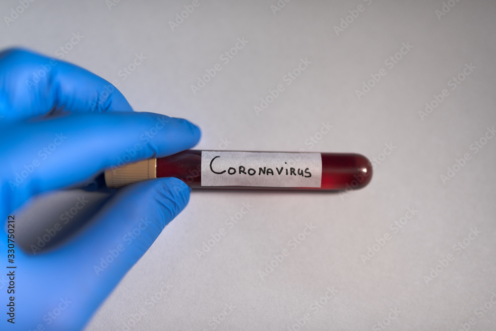 Fototapeta premium Test tube with coronavirus