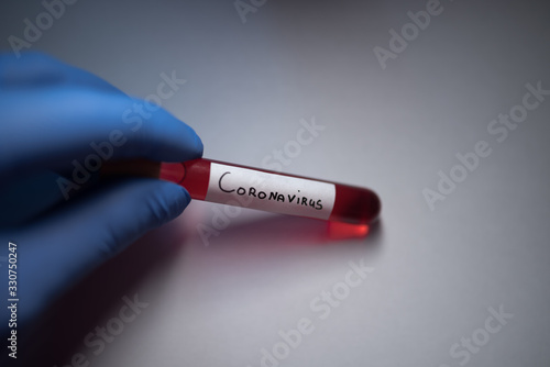 Test tube with coronavirus 