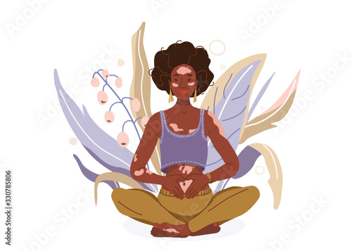 Love yourself with problem vitiligo skin vector background. Self-care body wellness concept. African woman sitting in yoga posture. Girl fold her hands on her stomach, fingers formed heart shape