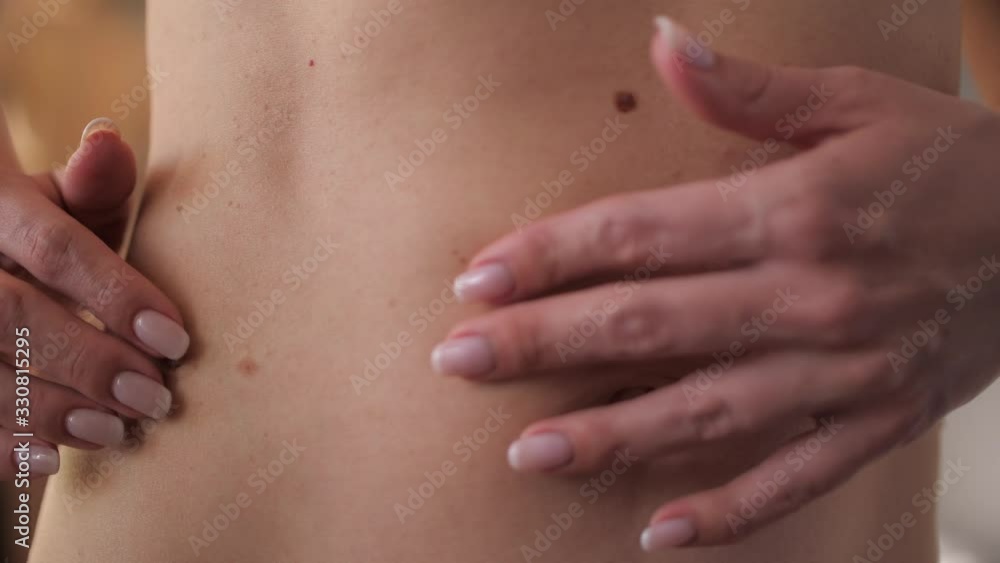 Young woman examining herself birthmarks diagnosis of skin cancer or melanoma close up. Young woman examining herself birthmarks diagnosis of skin cancer or melanoma close up.