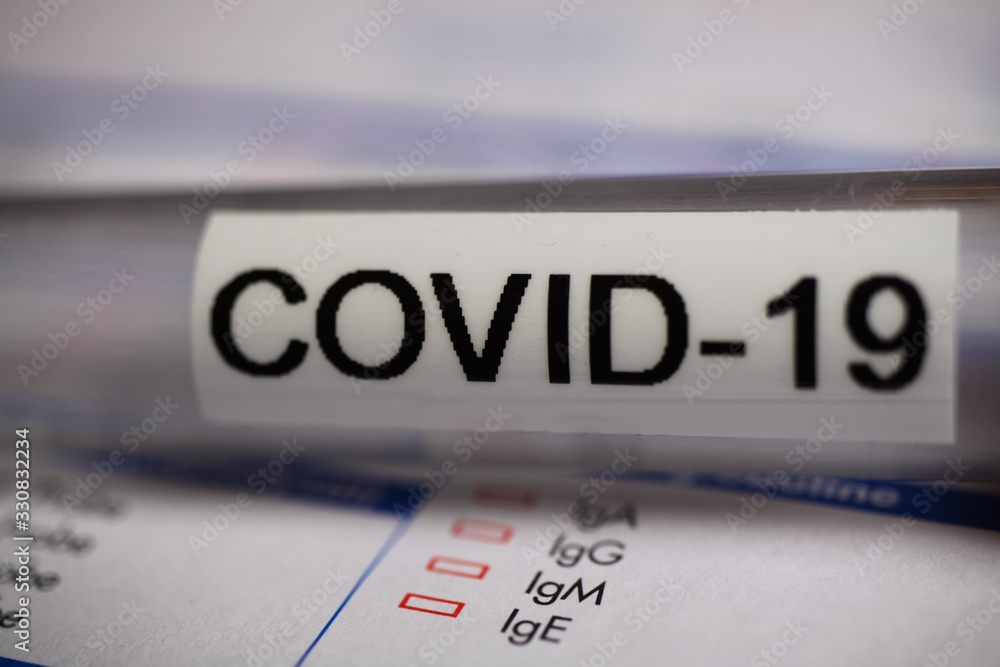 Corona virus covid-19 diagnostic, vaccination and research concept: macro closeup of isolated blood sample vial on laboratory requisition slip Corona virus covid-19 diagnostic, vaccination and research concept: macro closeup of isolated blood sample vial on laboratory requisition slip