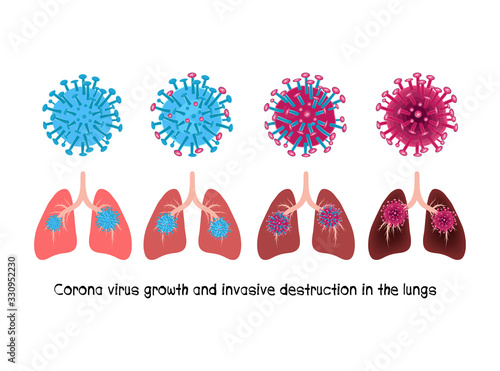 Development and evolution of Corona virus (2019-nCoV), microbiology concept. Disease germ, pathogen organism, infectious micro virology