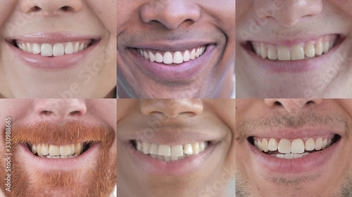 The Collage of Smiling Young People, Lips and Teeth Close Up