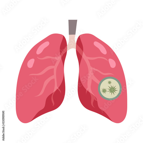 Disease lungs design. Vector Illustration