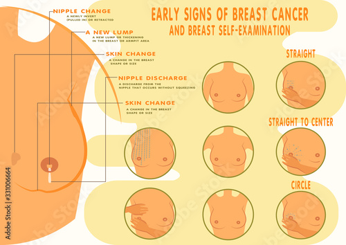 Breast Cancer Early Sign, Self Examination Banner.