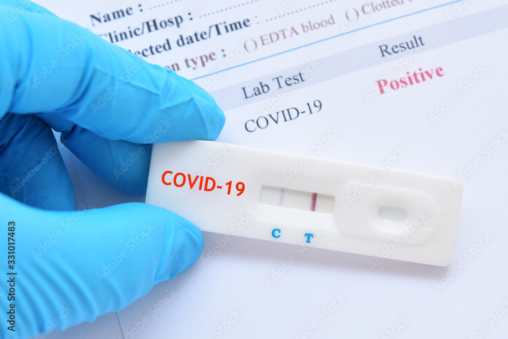 Obraz premium Positive test result by using rapid test device for COVID-19 virus, novel coronavirus 2019 found in Wuhan, China