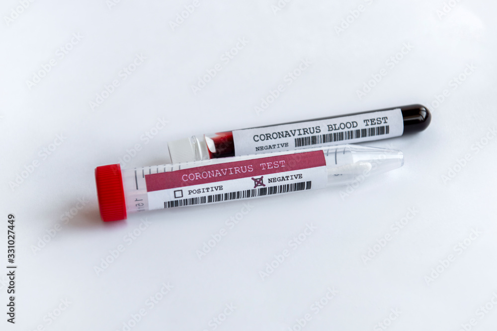 Obraz premium Two tubes with Coronavirus blood and spatula test