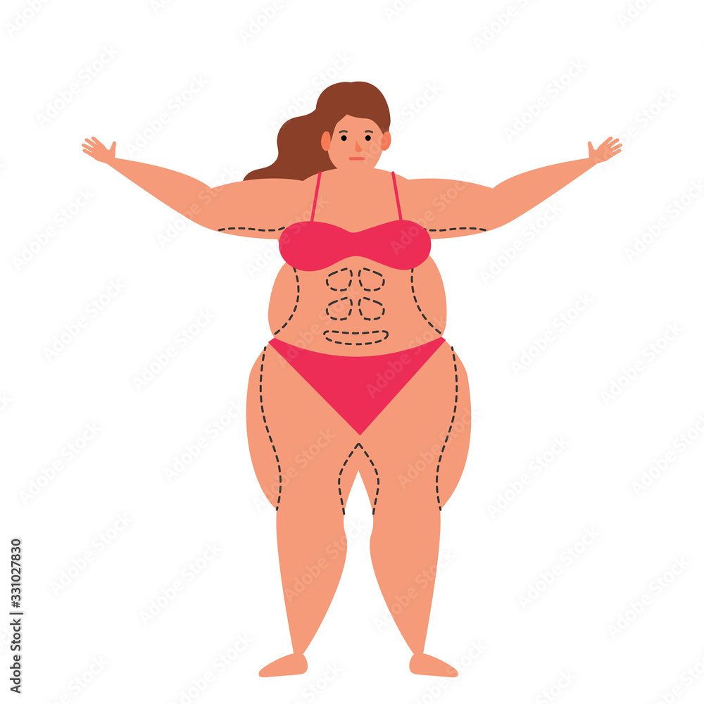 overweight obese woman with figure correction lines vector illustration overweight obese woman with figure correction lines vector illustration