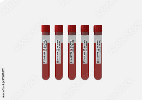 Coronavirus COVID-19 tests of blood in probe with positive and negative results. 3D illustration of medical equipment for testing people for virus in their bodies.