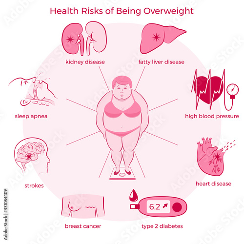 Health Risks of Being Overweight Set.  Medicine, pathology, anatomy, physiology, health. Vector illustration. Healthcare poster or banner template.