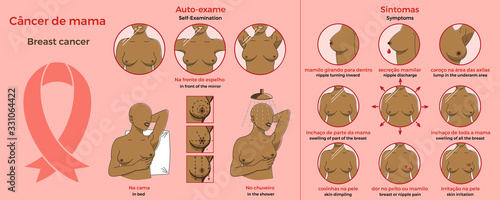 Self examination and Symptoms of breast cancer.  Medicine, pathology, anatomy, physiology, health. Infographic.  Healthcare poster or banner template. Text in portuguese and in English. Vector illustr photo