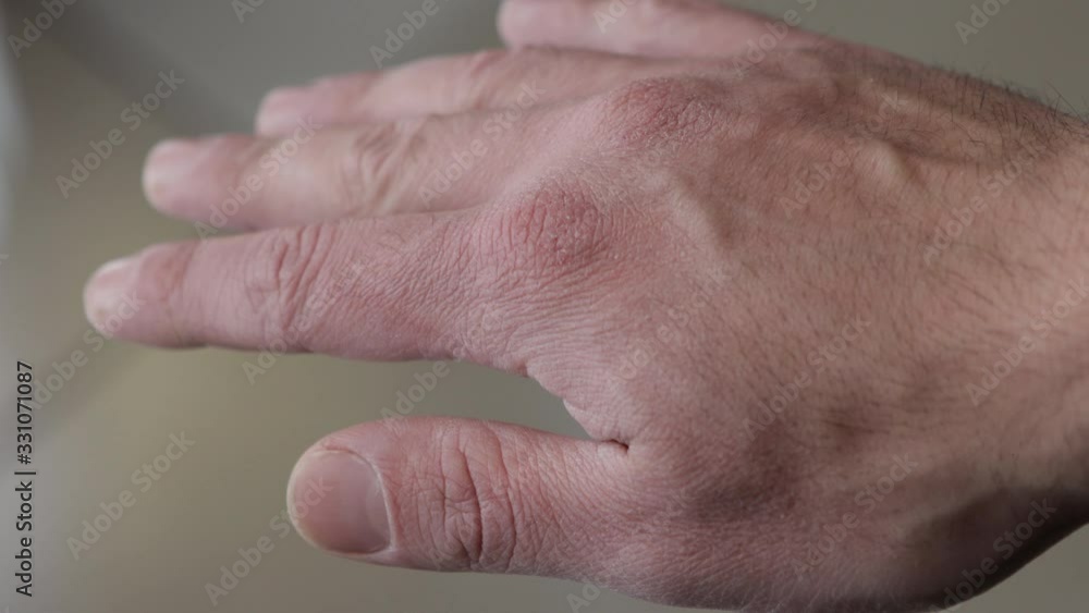 Dehydrated isolated athlete hand. Close up of caucasian hand with dry