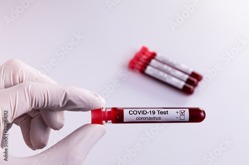 Blood samples tested for COVID-19 coronavirus - The patients tested positive for the aggressive virus. Health concept.
