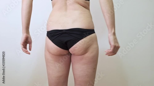 Woman shacking her fat buttock with cellulite, showing hanging fat close up