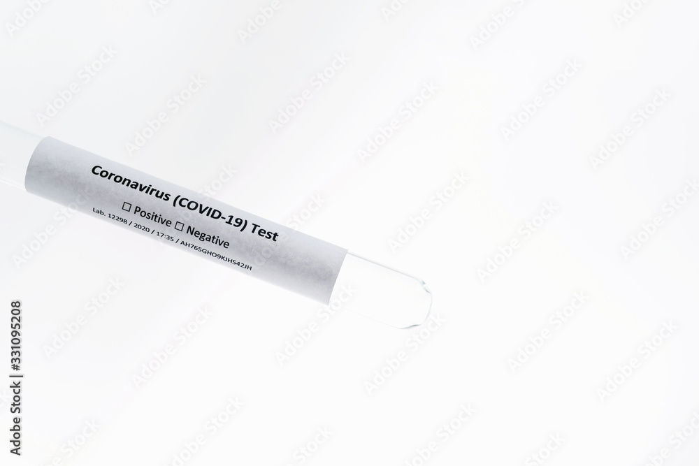 Test tube with biological material or DNA of human infected with coronavirus. White background isolated close up Test tube with biological material or DNA of human infected with coronavirus. White background isolated close up