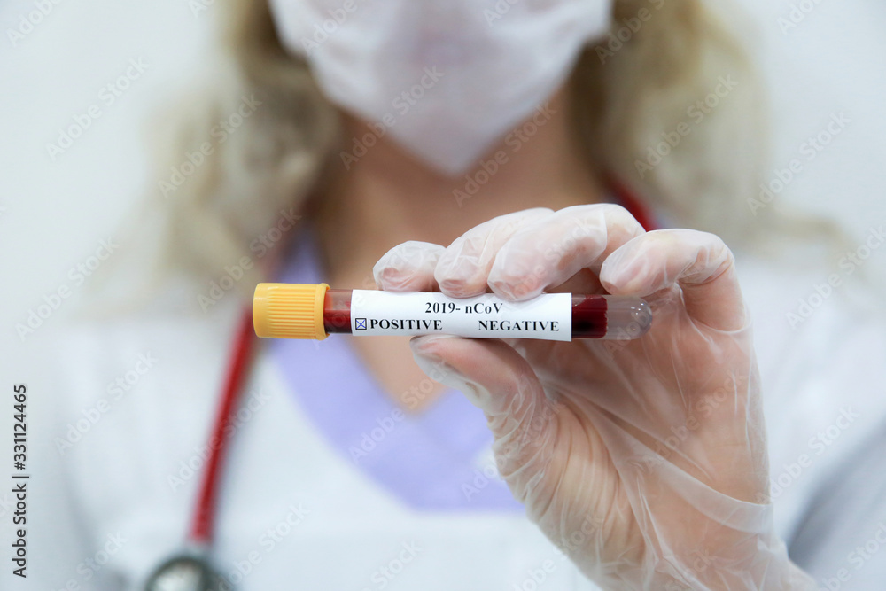 Nurse holding test tube with blood for 2019-nCoV analyzing. Novel Chinese Coronavirus blood test Concept. Corona Virus positive test Nurse holding test tube with blood for 2019-nCoV analyzing. Novel Chinese Coronavirus blood test Concept. Corona Virus positive test
