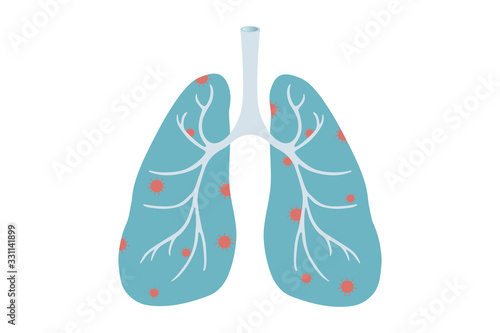 vector illustration of coronavirus-infected lungs