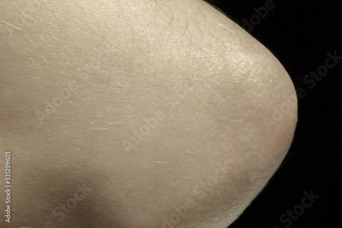 Beauty. Detailed texture of human skin. Close up shot of young caucasian female body. Skincare, bodycare, healthcare, hygiene and medicine concept. Looks beauty and well-kept. Dermatology.