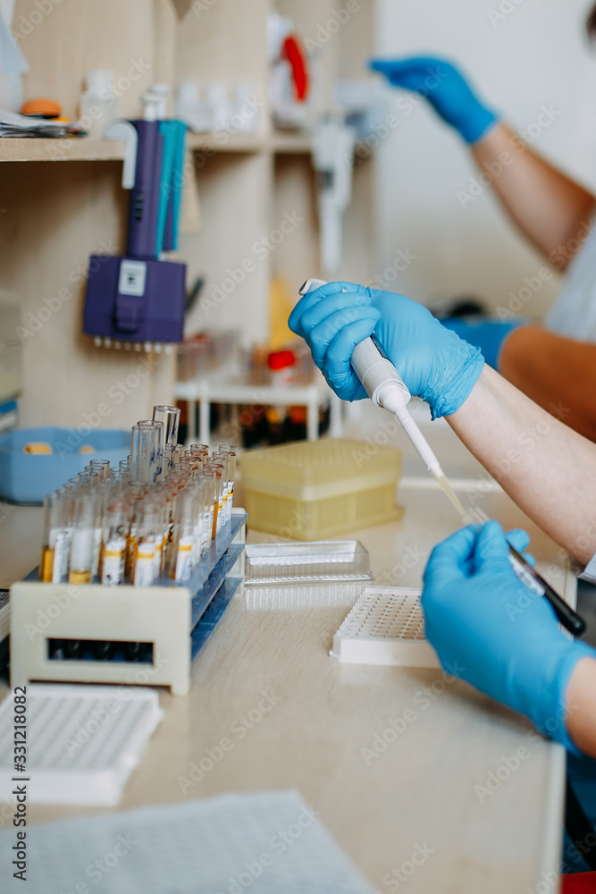 Blood test process in laboratory. Doctor hands making blood test. Many