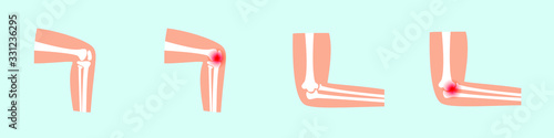 Set of vector illustration of elbow pain and knee pain.
