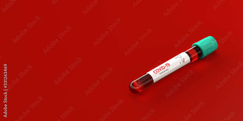 Corona virus coronavirus Positive COVID-19 test tube sample of blood 3d illustration Corona virus coronavirus Positive COVID-19 test tube sample of blood 3d illustration