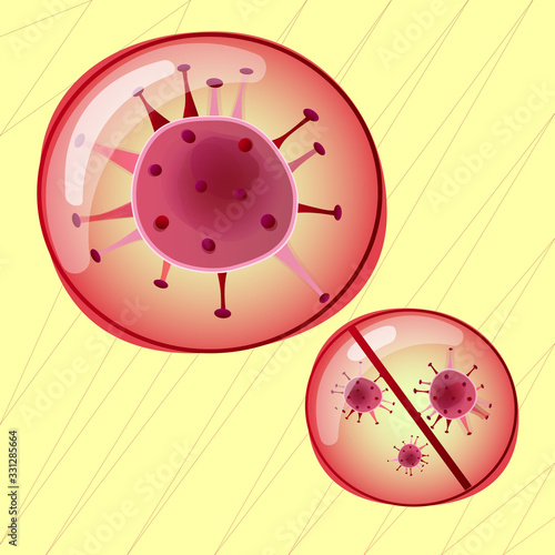 China epidemic nCoV in Wuhan Coronavirus 2019. Pneumonia disease