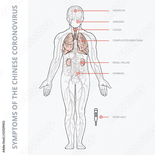 A schematic illustration of the human body with an infographic of the symptoms of coronavirus covid 19. 