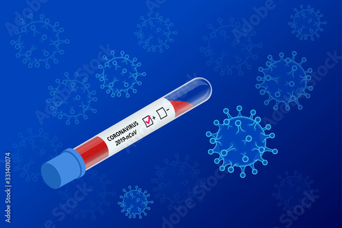 Pandemic Chinese coronavirus COVID-19. Coronavirus outbreak, coronaviruses influenza as dangerous flu strain cases as a pandemic medical health risk, virus attacks the respiratory tract