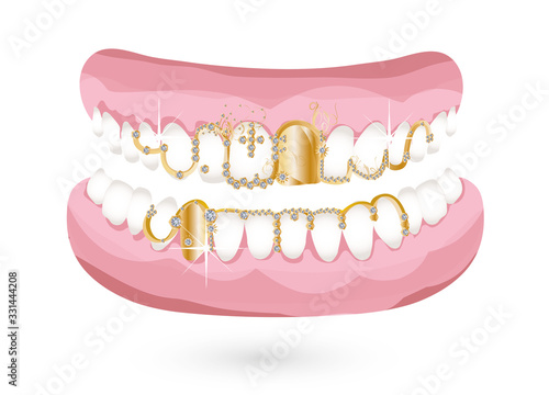Gebiss mit stylischem Grill in Gold und Diamanten