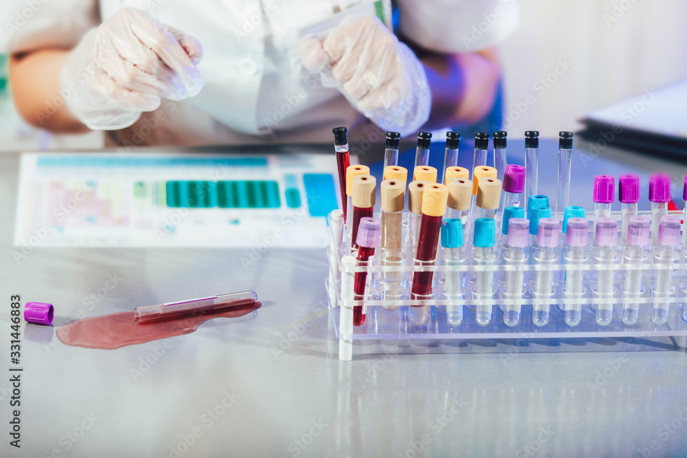 Scientist dropping liquid in a test tube in a laboratory. Accidents in the laboratory. Scientist dropping liquid in a test tube in a laboratory. Accidents in the laboratory.