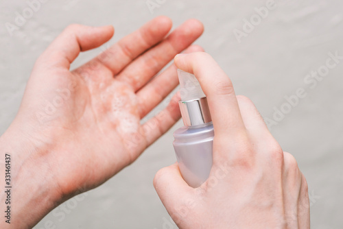 Girl sprays a disinfectant spray on the palm. Fluid to prevent the spread of viruses and bacteria. Hygiene and Health Protection.