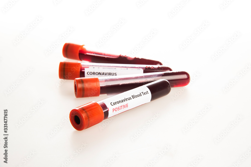 coronavirus Covid-19 blood test sample tubes isolated coronavirus Covid-19 blood test sample tubes isolated