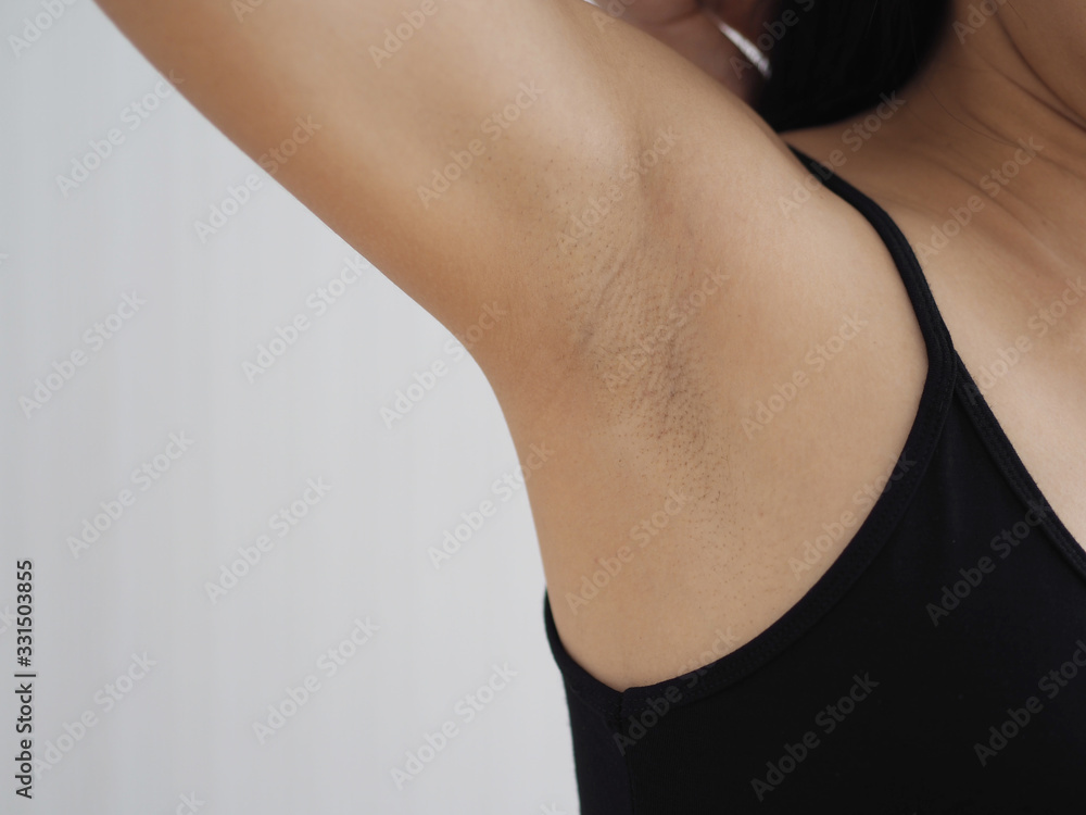 black armpit and bad odor problem in asian woman use for white and smooth or smelly armpit cream ,gel and sprey or wax product concept