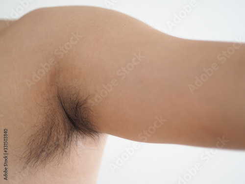 Cuadro en lienzo armpit hair in asian man use for hair removal laser or wax product on white background