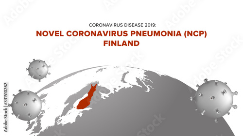 Coronavirus Disease 2019: Novel Coronavirus Pneumonia (NCP) Finland