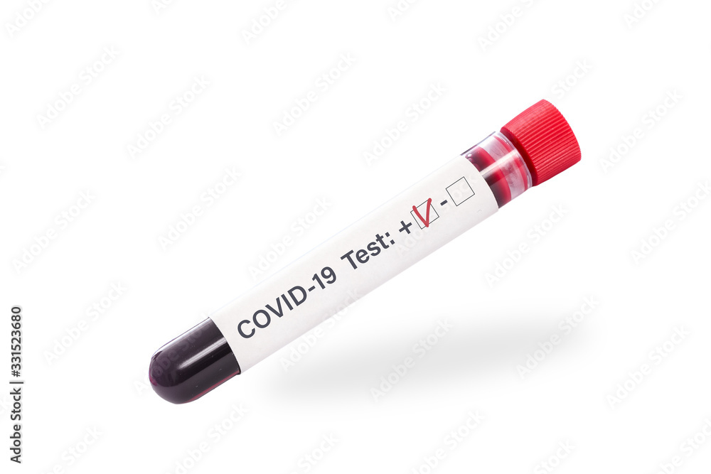 Virus COVID-19 pandemic concept - single blood sample tube with positive test sign isolated on a white background Virus COVID-19 pandemic concept - single blood sample tube with positive test sign isolated on a white background