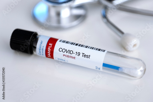 Testing for presence of coronavirus. Tube containing a swab sample for SARS-CoV-2 (COVID-19). Test form in the background. photo