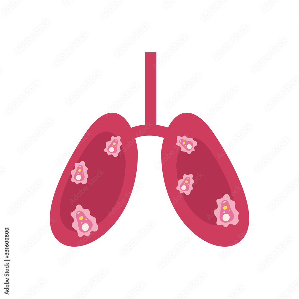 lungs with covid 19 virus icon, flat style lungs with covid 19 virus icon, flat style