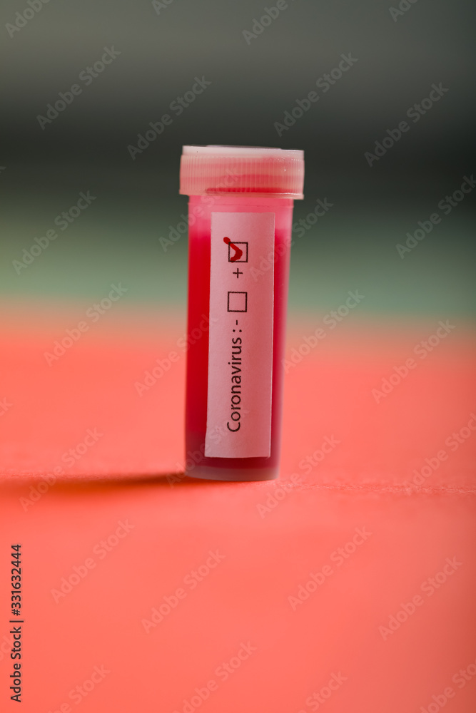 Positive COVID-19 test and laboratory sample of blood testing Positive COVID-19 test and laboratory sample of blood testing