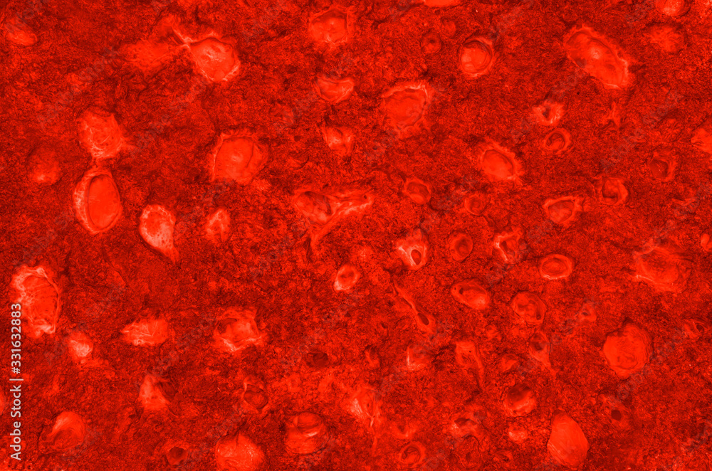 Virus cell Chinese pathogen respiratory flu coronavirus COVID-19 under the microscope. Virus cell Chinese pathogen respiratory flu coronavirus COVID-19 under the microscope.