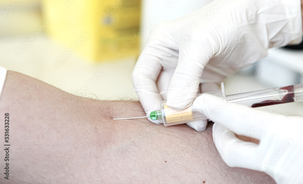 A blood test is a laboratory analysis performed on a blood sample that is usually extracted from a vein in the arm using a hypodermic needle, or via fingerprick. Modern hospital hematology laboratory. A blood test is a laboratory analysis performed on a blood sample that is usually extracted from a vein in the arm using a hypodermic needle, or via fingerprick. Modern hospital hematology laboratory.