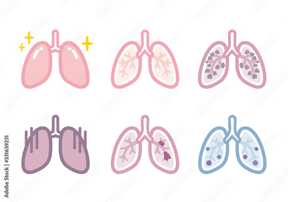 Lung disease illustration