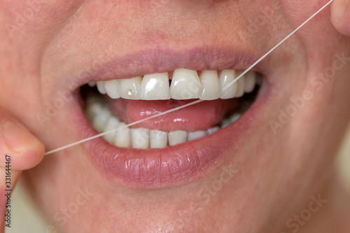 Middle-aged woman flossing her teeth © michaelheim