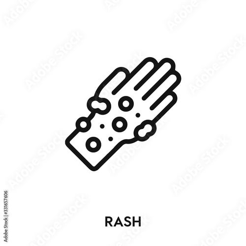 rash icon vector. allergy icon vector symbol illustration. Modern simple vector icon for your design. rash icon vector	