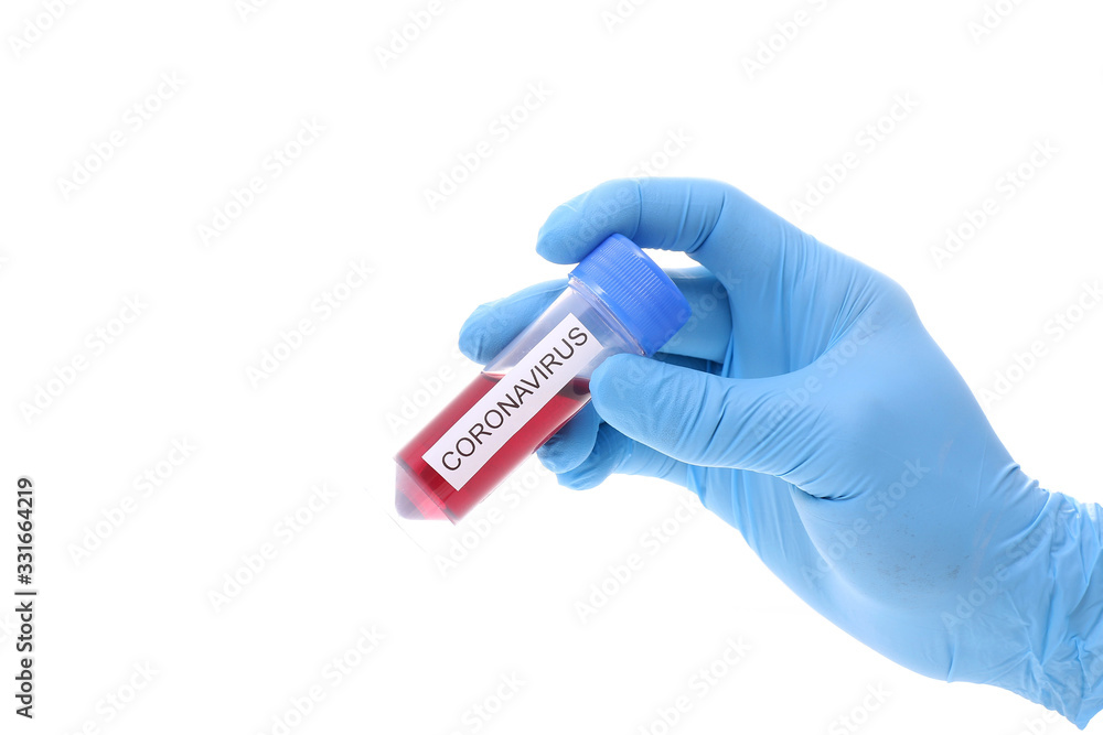 Obraz premium Coronavirus 2019-nCoV Blood Sample. Corona virus outbreaking. Epidemic virus Respiratory Syndrome.