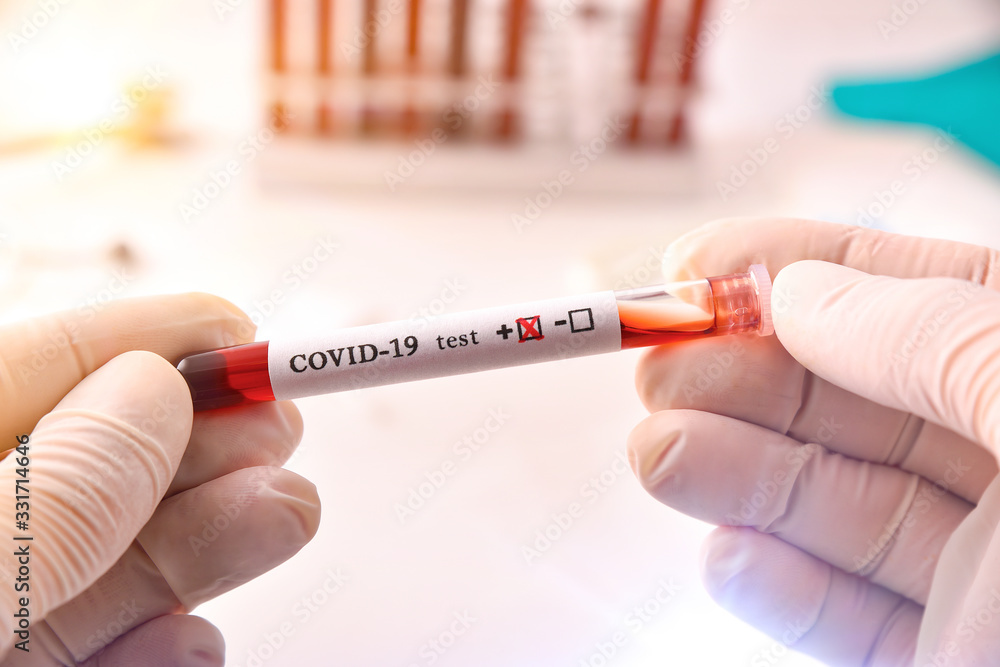 Fototapeta premium Hands taking tube with blood sample infected covid-19 in laboratory