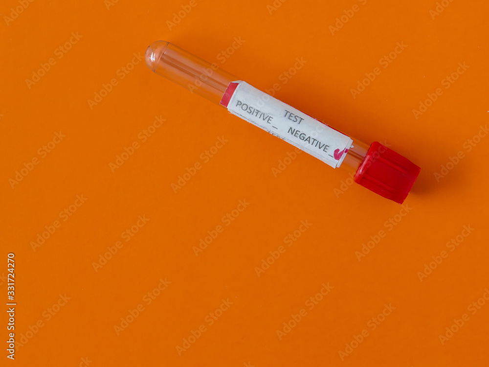 Obraz premium Blod tube wit text positive and negative