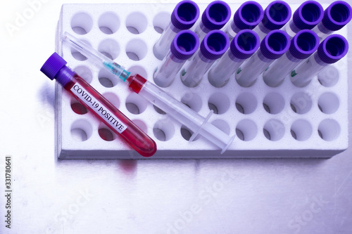 a blood sample in a test tube. Positive test for Coronavirus, first detected in Wuhan, China