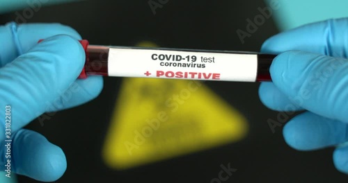 Doctor holds COVID 19 Coronavirus vaccine in his hand, infected blood sample in the sample tube, Vaccine and syringe injection It use for prevention, immunization and treatment from COVID-19